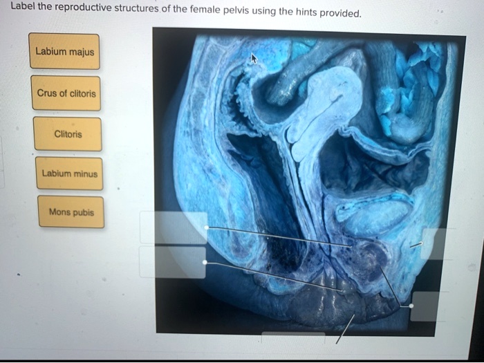 Label the reproductive structures of the female pelvis