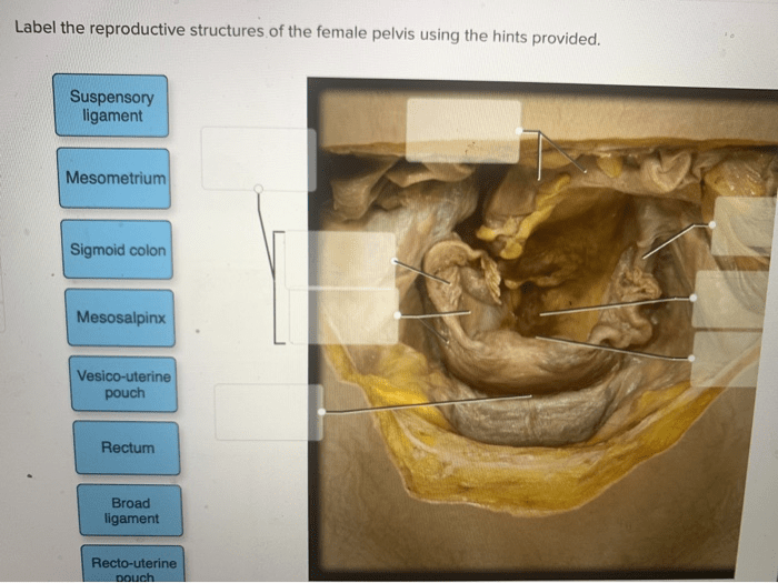 Label the reproductive structures of the female pelvis